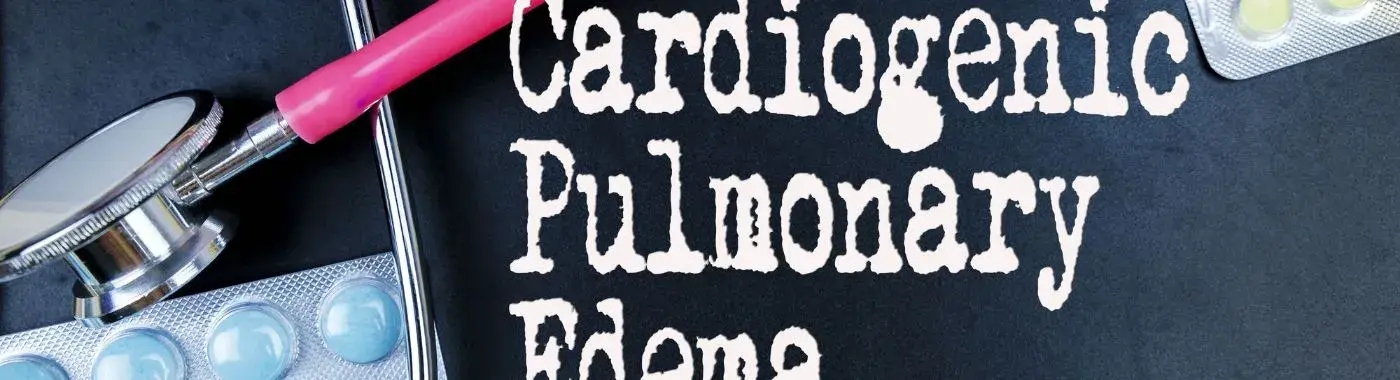 Cardiogenic Pulmonary Edema - Causes, Symptoms, Diagnosis, Treatment, and Prevention