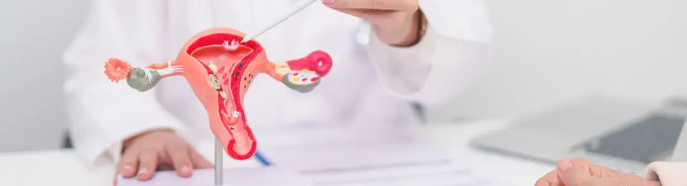 Cervical Cancer - Early Signs, Risk Factors, Diagnosis, and Treatment Explained