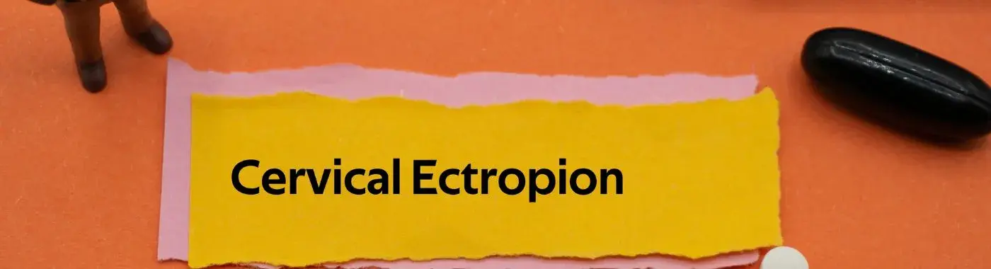 Cervical Ectropion - Causes, Symptoms, Diagnosis, Treatment, and Prevention