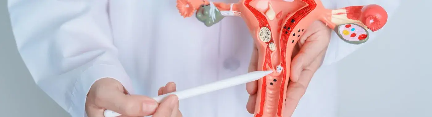 Cervical Polyp - Causes, Symptoms, Diagnosis, Treatment, and Prevention