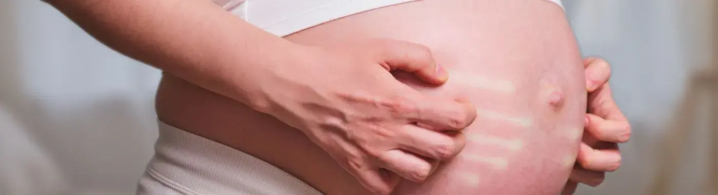 Cholestasis Of Pregnancy - Causes, Symptoms, Diagnosis, Treatment, and Prevention