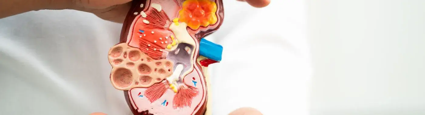 Chronic Kidney Disease