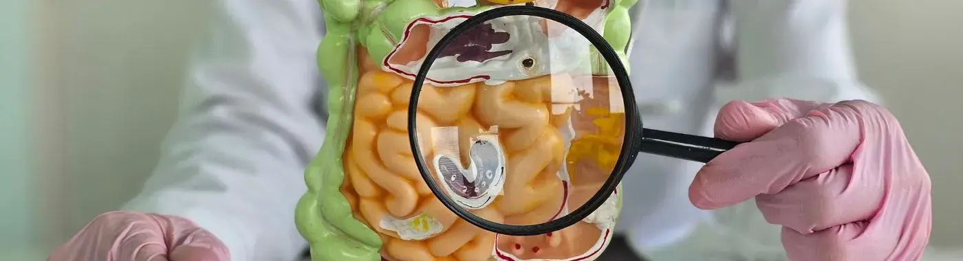 Crohn's Disease - Symptoms, Risks, Diagnosis, and Treatment