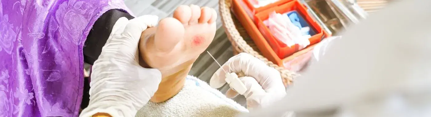 Diabetic Feet - Causes, Symptoms, Diagnosis, Treatment, and Prevention