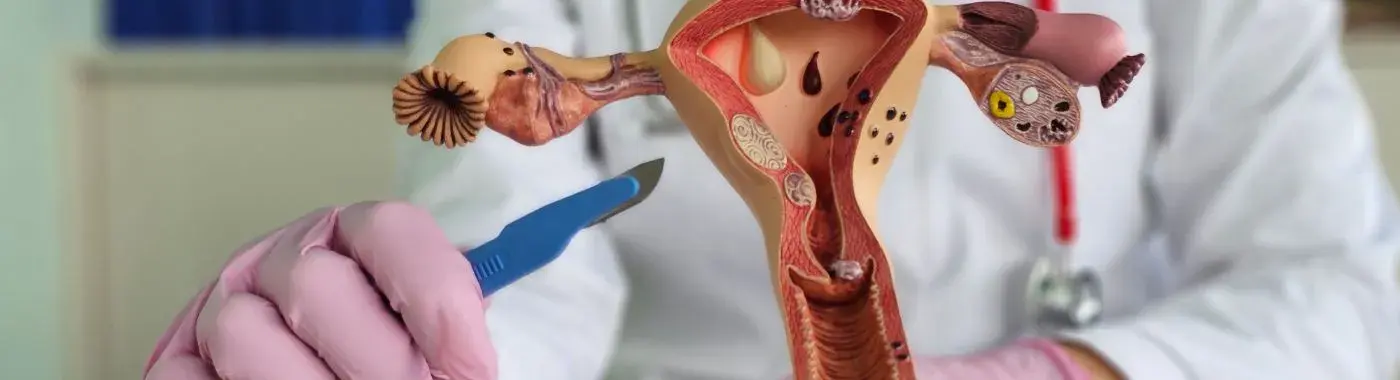 Double Uterus - Causes, Symptoms, Diagnosis, Treatment, and Prevention