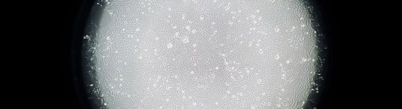 Embryonal Tumors - Early Signs, Risk Factors, Diagnosis, and Treatment Explained