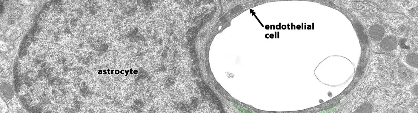 Endothelial Dysfunction - Causes, Symptoms, Diagnosis, Treatment, and Prevention