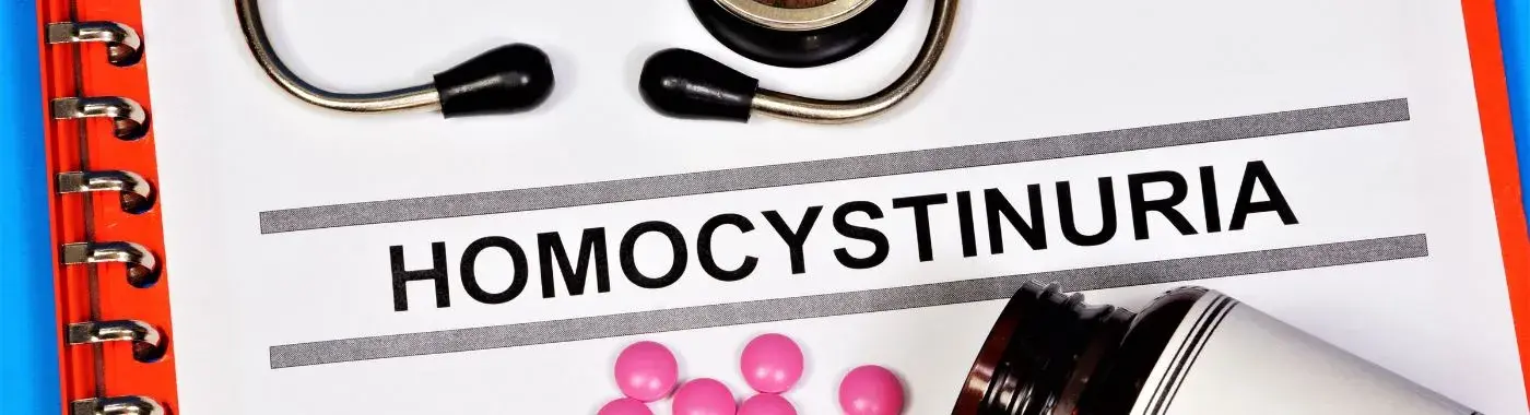 Homocystinuria - Causes, Symptoms, Diagnosis, Treatment, and Prevention