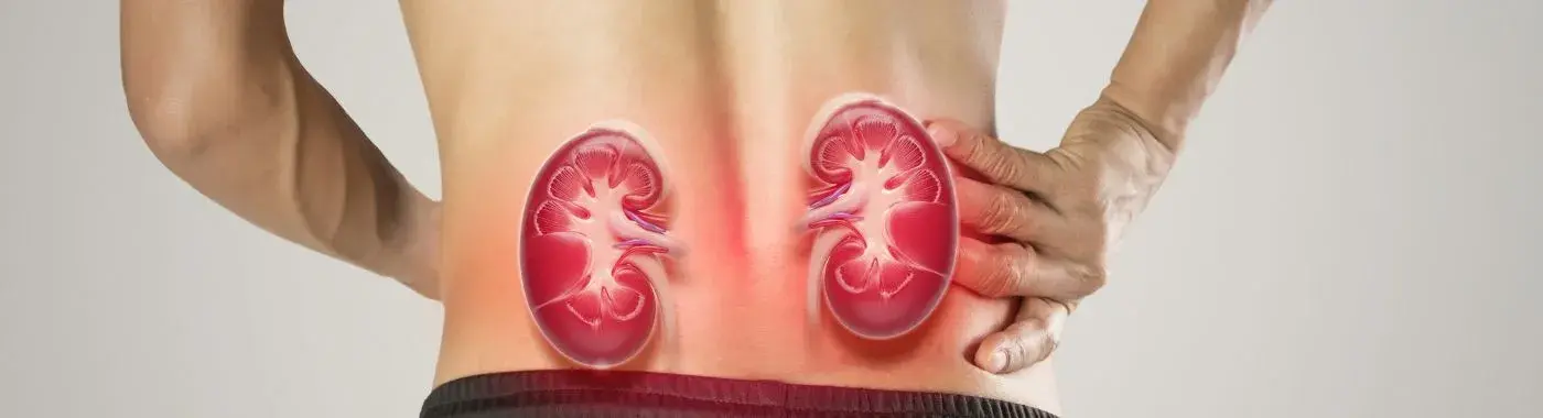 Kidney Infection - Causes, Symptoms, Diagnosis, Treatment, and Prevention