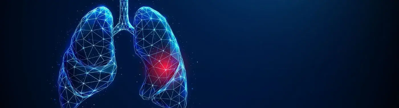 Lung Cancer - Early Signs, Risk Factors, Diagnosis, and Treatment Explained