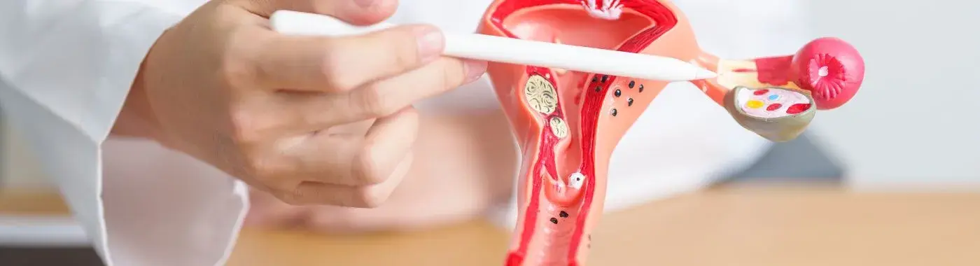 Ovarian Cancer - Early Signs, Risk Factors, Diagnosis, and Treatment Explained