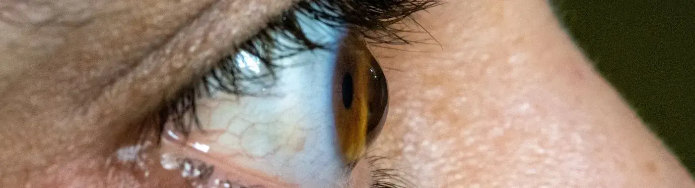 Quadrantanopia - Causes, Symptoms, Diagnosis, Treatment, and Prevention