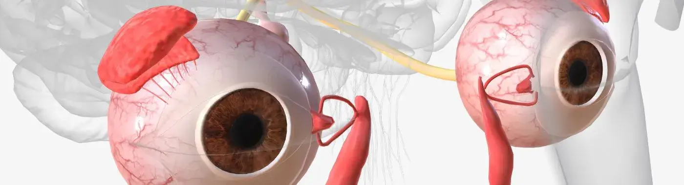 Scotoma - Causes, Symptoms, Diagnosis, Treatment, and Prevention