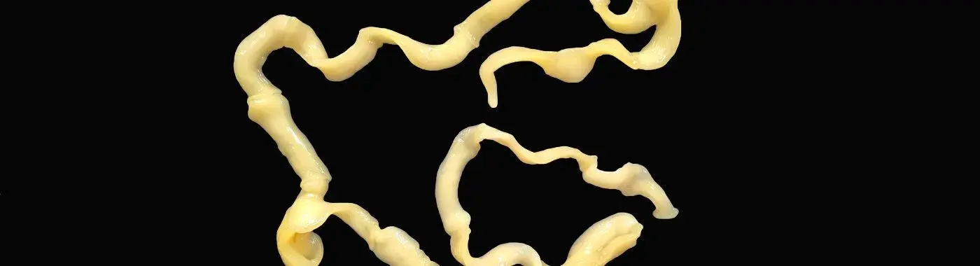 サナダムシ感染症 - 原因、症状、診断、治療