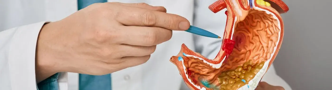 Vred – príčiny, symptómy, diagnostika, liečba a prevencia