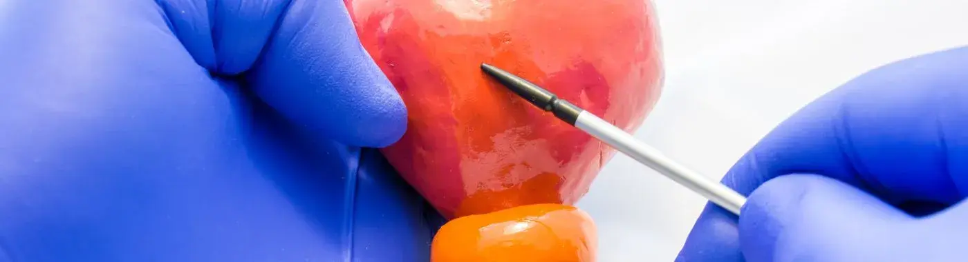 Bladder Exstrophy - Causes, Symptoms, Diagnosis, Treatment, and Prevention