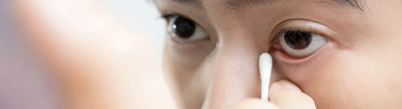 Ectropion - Causes, Symptoms, Diagnosis, Treatment, and Prevention