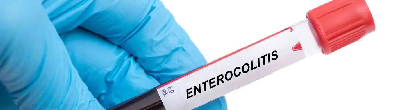 Enterocolitis - Causes, Symptoms, Diagnosis, Treatment, and Prevention