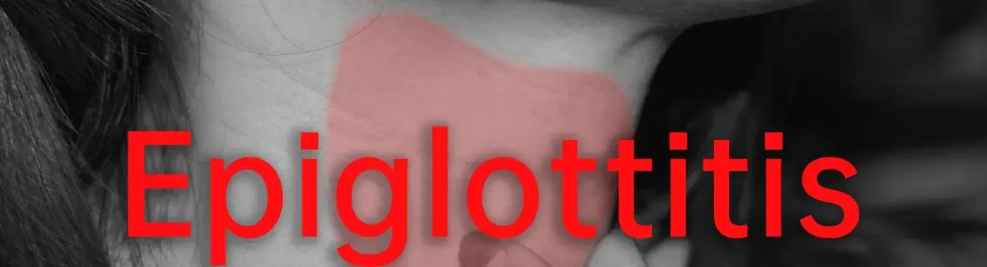 Epiglottitis