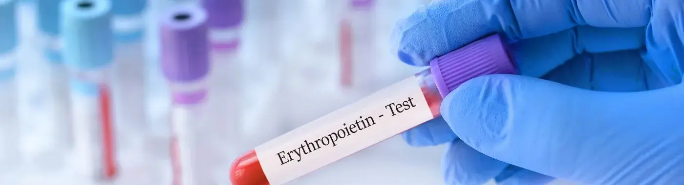 Erythrocytosis - Causes, Symptoms, Diagnosis, Treatment, and Prevention