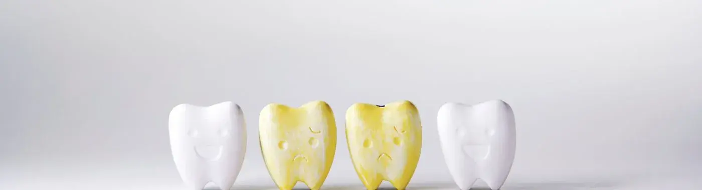 Fluorosis - Causes, Symptoms, Diagnosis, Treatment, and Prevention