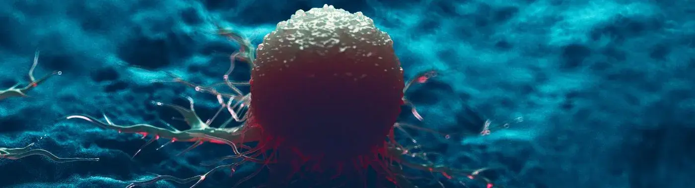 Giant Cell Tumors - Causes, Symptoms, Diagnosis, Treatment, and Prevention