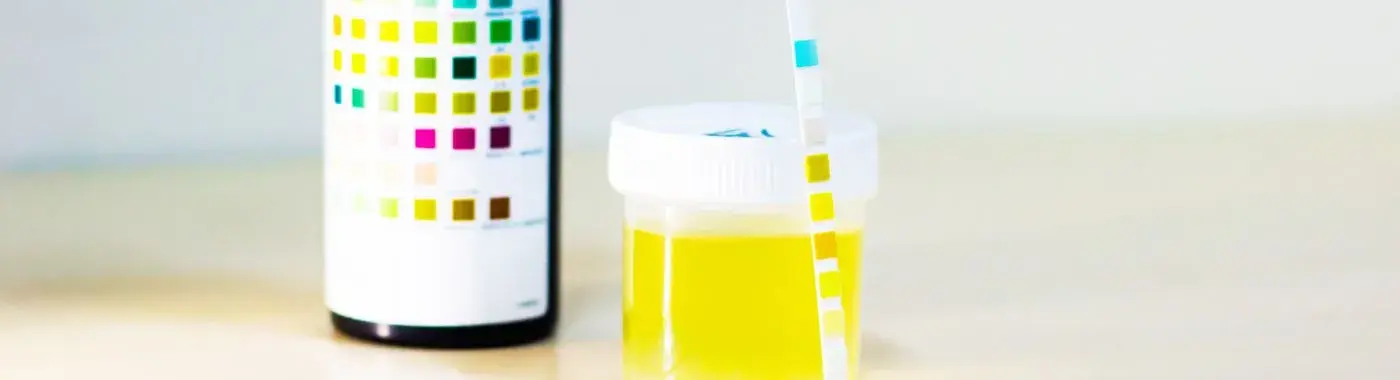 Glycosuria - Causes, Symptoms, Diagnosis, Treatment, and Prevention