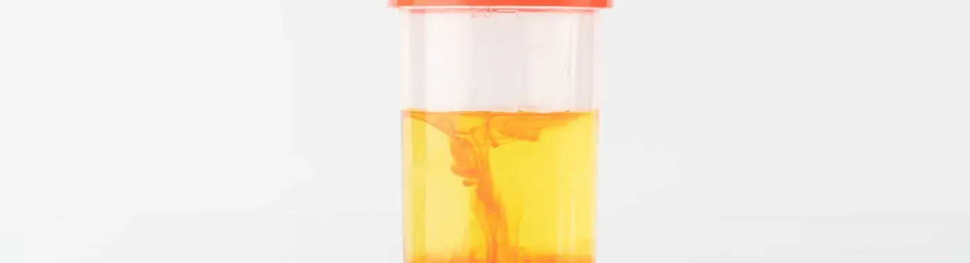 Hemolytic Uremic Syndrome - Causes, Symptoms, Diagnosis, Treatment, and Prevention