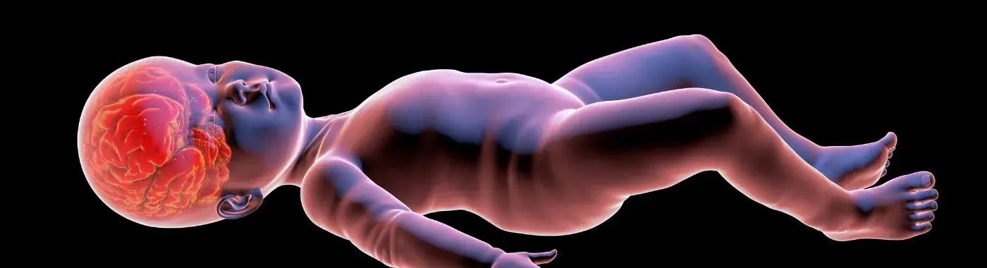 Weaver Syndrome - Causes, Symptoms, Diagnosis, Treatment, and Prevention