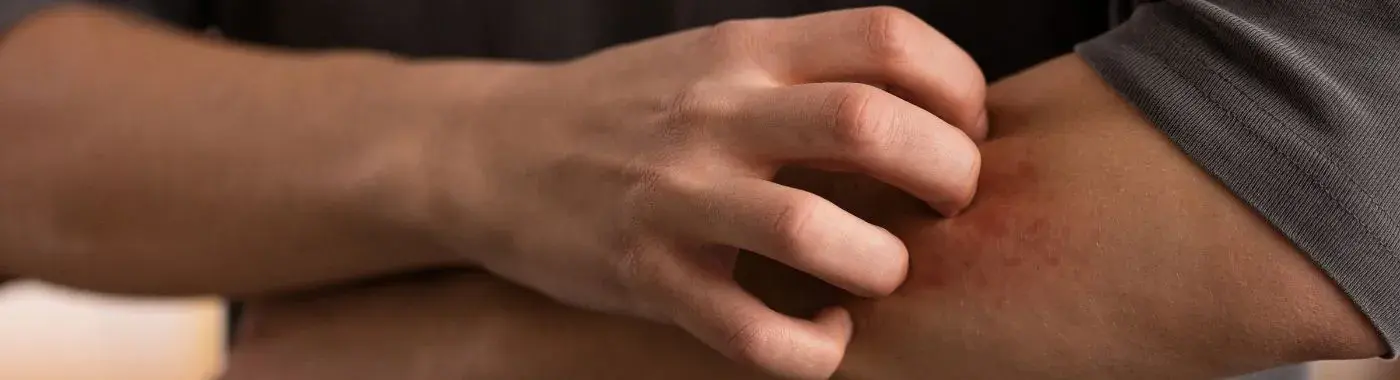 Basophilia - Causes, Symptoms, Diagnosis, Treatment, and Prevention