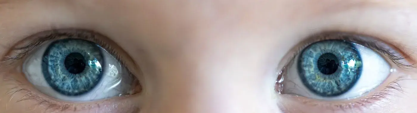 Buphthalmos - Causes, Symptoms, Diagnosis, Treatment, and Prevention