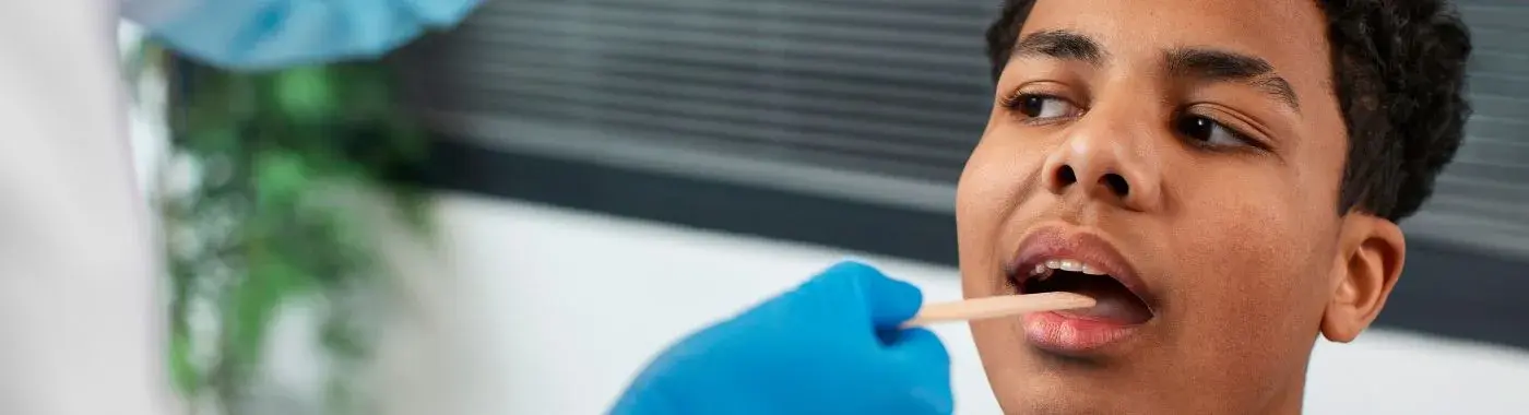 Canker Sores - Causes, Symptoms, Diagnosis, Treatment, and Prevention