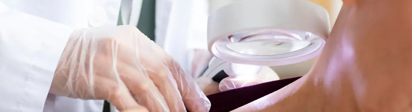 Dermoid Cyst - Causes, Symptoms, Diagnosis, Treatment, and Prevention