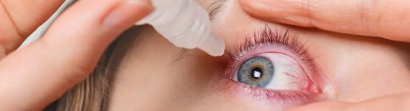 Eye Infection - Causes, Symptoms, Diagnosis, Treatment, and Prevention