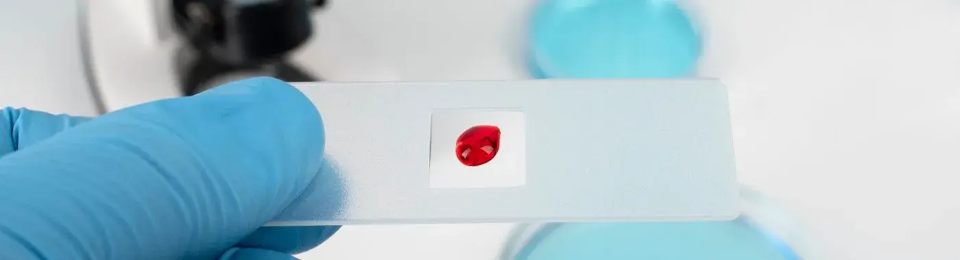 Hemophilia B - Causes, Symptoms, Diagnosis, Treatment, and Prevention