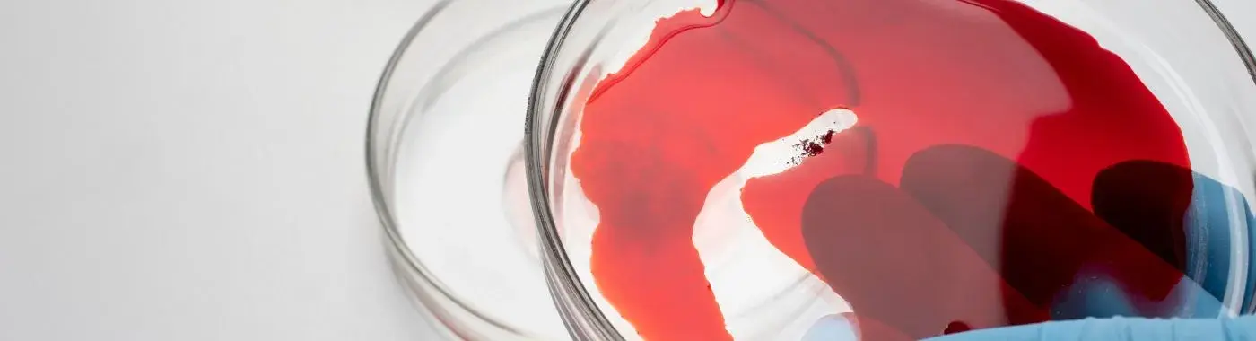 Hemophilia C - Causes, Symptoms, Diagnosis, Treatment, and Prevention