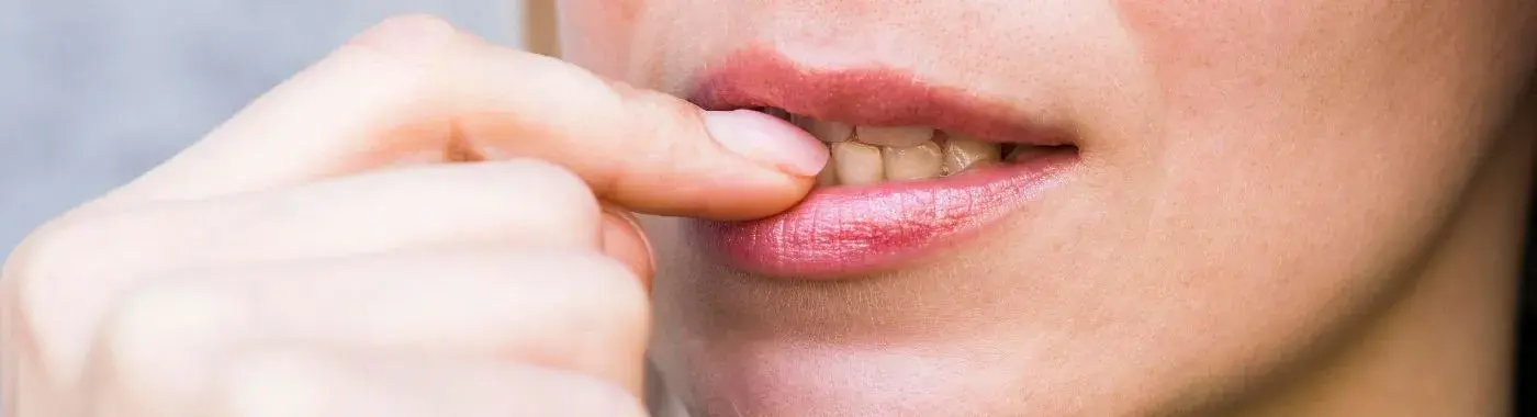 Herpes Simplex - Causes, Symptoms, Diagnosis, Treatment, and Prevention