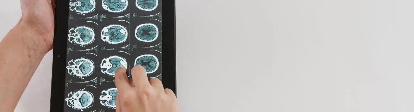 High Grade Glioma - Causes, Symptoms, Diagnosis, Treatment, and Prevention