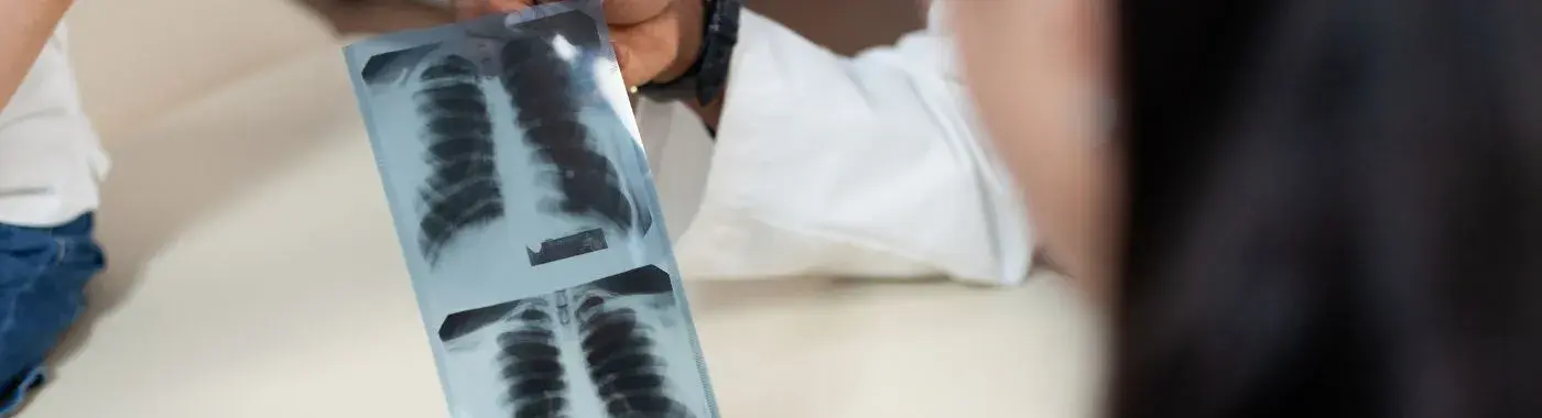 Hyperinflated Lungs - Causes, Symptoms, Diagnosis, Treatment, and Prevention