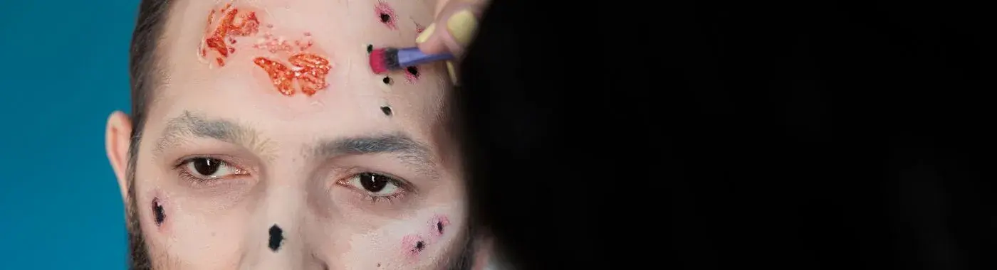 Lichen Sclerosus - Causes, Symptoms, Diagnosis, Treatment, and Prevention