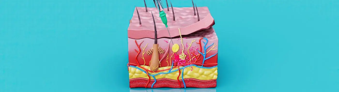 Lipohypertrophy - Causes, Symptoms, Diagnosis, Treatment, and Prevention