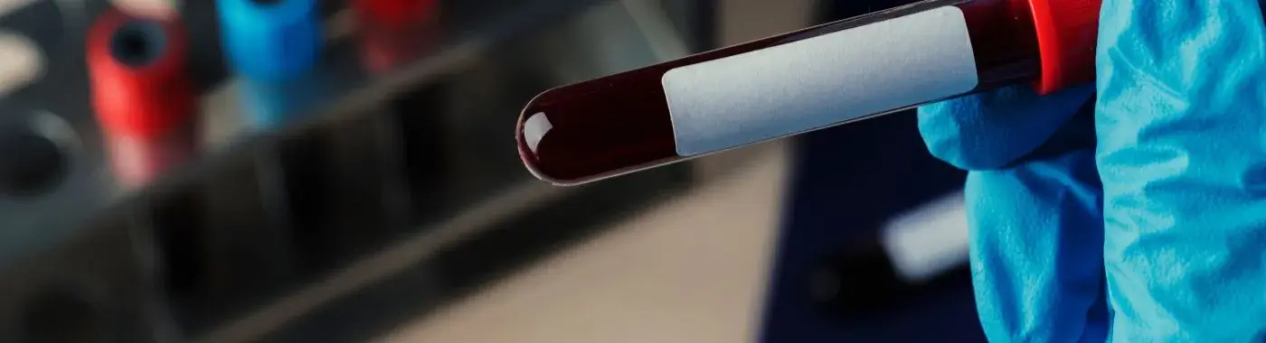 Lithium Toxicity - Causes, Symptoms, Diagnosis, Treatment, and Prevention