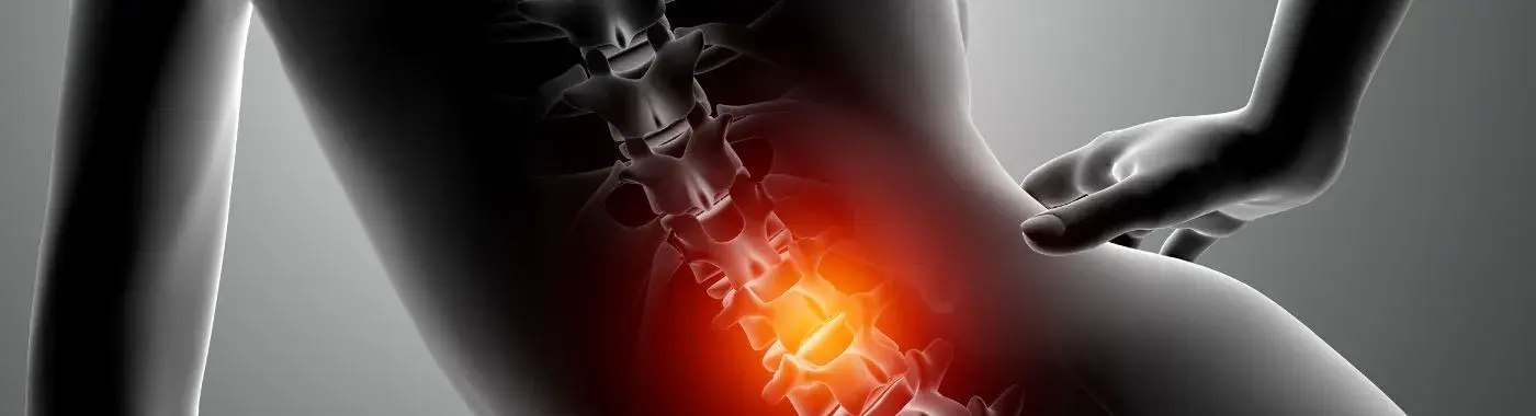 Lumbar Radiculopathy