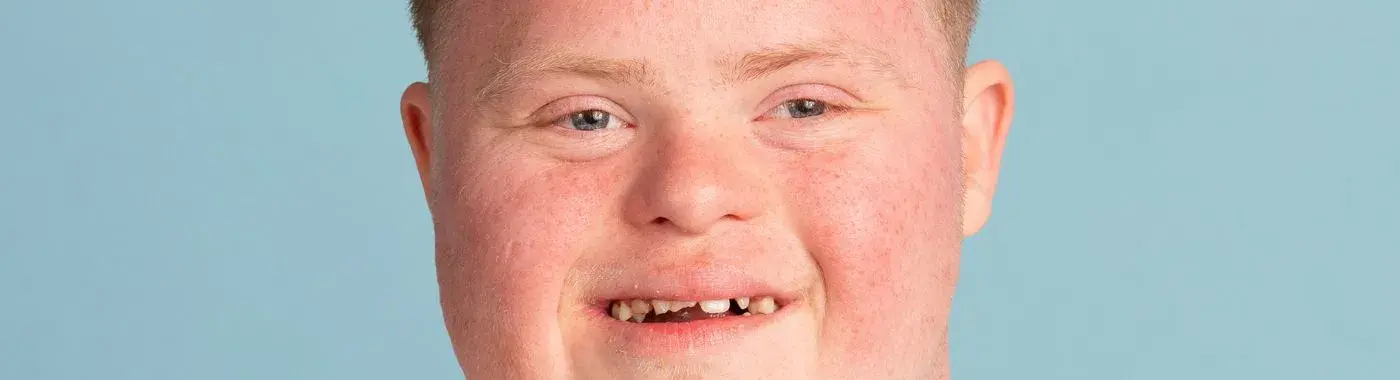 Macrocephaly - Causes, Symptoms, Diagnosis, Treatment, and Prevention