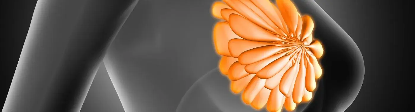 Mammary Duct Ectasia - Causes, Symptoms, Diagnosis, Treatment, and Prevention