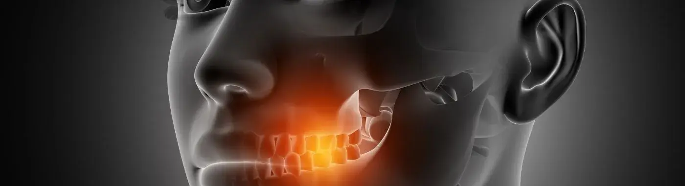Mandibular Tori - Causes, Symptoms, Diagnosis, Treatment, and Prevention