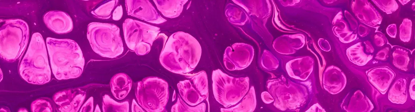 Mantle Cell Lymphoma - Causes, Symptoms, Diagnosis, Treatment, and Prevention