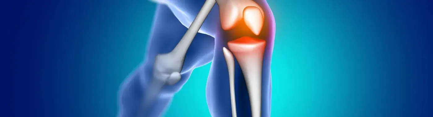 Mcl Tear - Causes, Symptoms, Diagnosis, Treatment, and Prevention