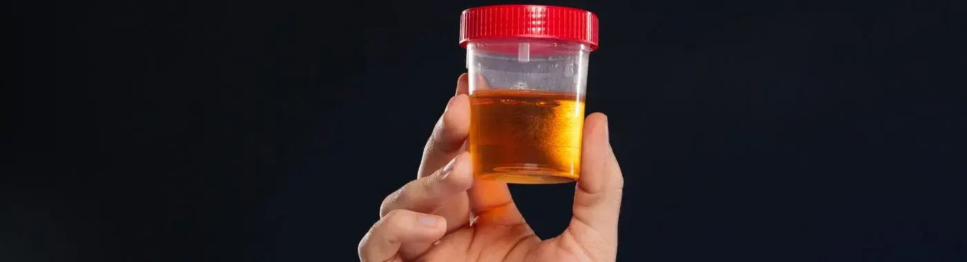 Microhematuria - Causes, Symptoms, Diagnosis, Treatment, and Prevention