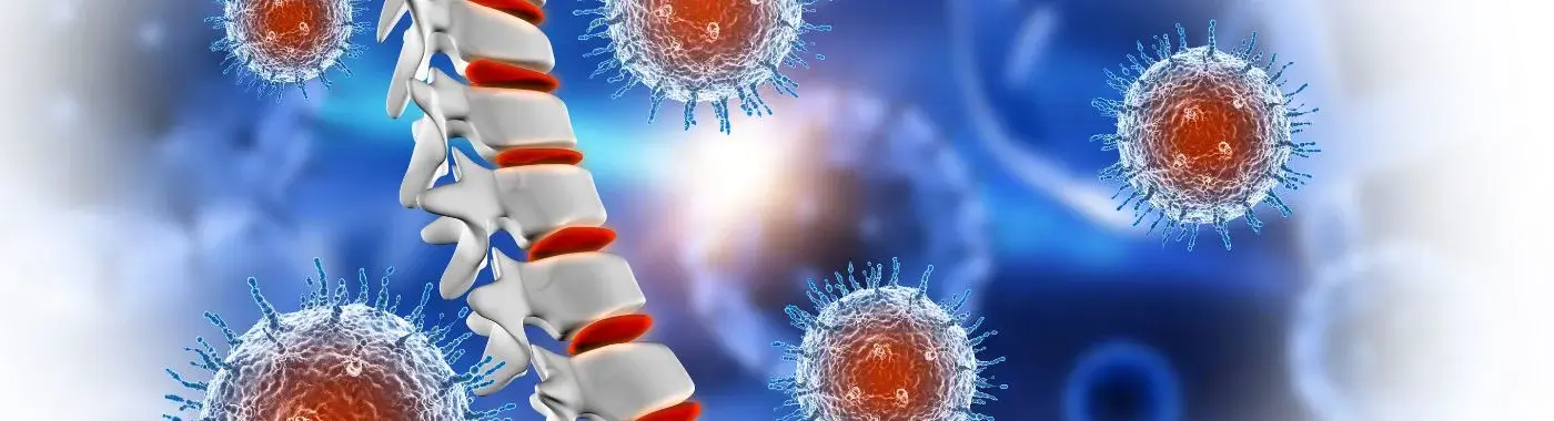 Osteopoikilosis - Causes, Symptoms, Diagnosis, Treatment, and Prevention